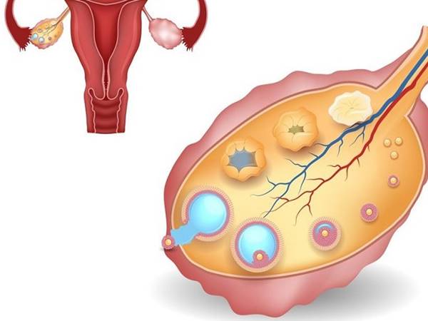 Chia sẻ các dấu hiệu trứng đã rụng xong ở chị em phụ nữ 2